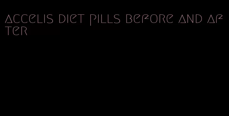 accelis diet pills before and after