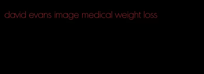 david evans image medical weight loss