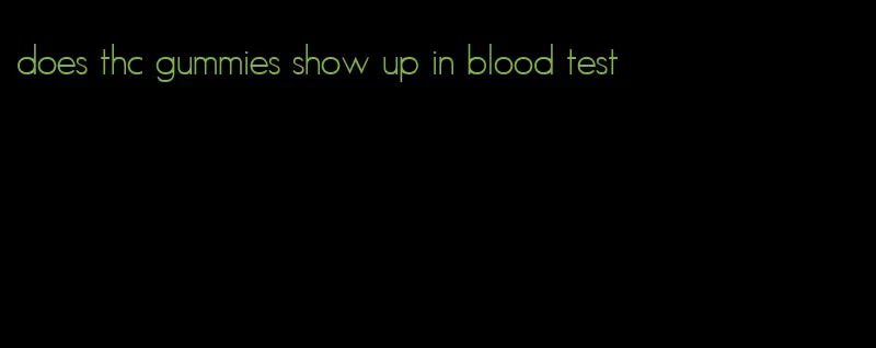 does thc gummies show up in blood test