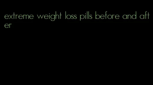 extreme weight loss pills before and after