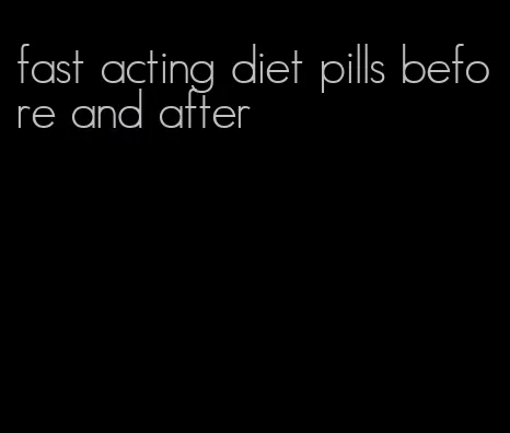 fast acting diet pills before and after