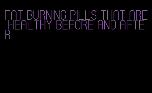 fat burning pills that are healthy before and after