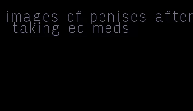 images of penises after taking ed meds