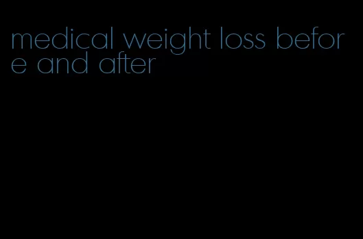 medical weight loss before and after