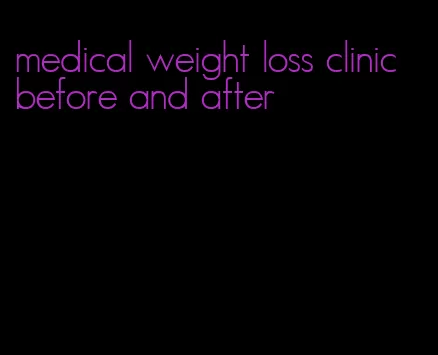 medical weight loss clinic before and after