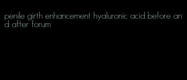 penile girth enhancement hyaluronic acid before and after forum