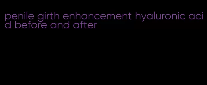 penile girth enhancement hyaluronic acid before and after