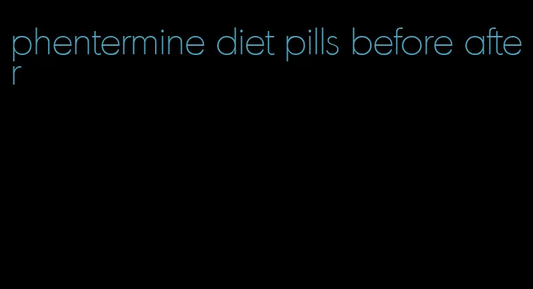 phentermine diet pills before after