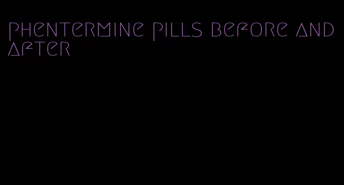 phentermine pills before and after