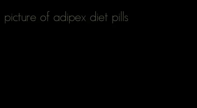 picture of adipex diet pills