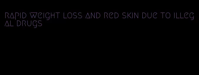 rapid weight loss and red skin due to illegal drugs