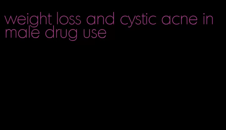 weight loss and cystic acne in male drug use