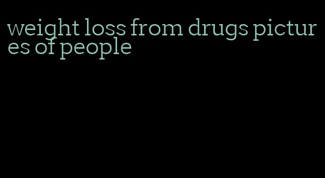 weight loss from drugs pictures of people