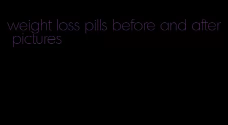 weight loss pills before and after pictures