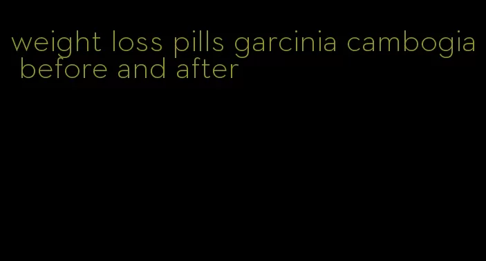 weight loss pills garcinia cambogia before and after